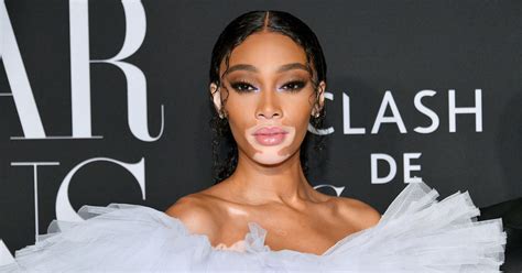 winnie harlow net worth|This Is How Much Winnie Harlow Is Actually Worth